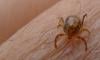 Sindh records first Congo fever case of year